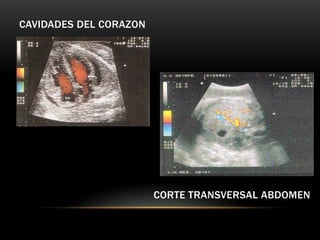 CAVIDADES DEL CORAZON




                        CORTE TRANSVERSAL ABDOMEN
 