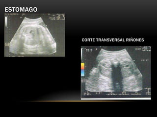 ESTOMAGO



           CORTE TRANSVERSAL RIÑONES
 