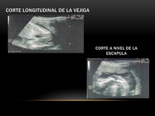 CORTE LONGITUDINAL DE LA VEJIGA




                                  CORTE A NIVEL DE LA
                                      ESCAPULA
 