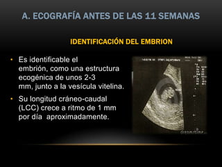 A. ECOGRAFÍA ANTES DE LAS 11 SEMANAS

                  IDENTIFICACIÓN DEL EMBRION

• Es identificable el
  embrión, como una estructura
  ecogénica de unos 2-3
  mm, junto a la vesícula vitelina.
• Su longitud cráneo-caudal
  (LCC) crece a ritmo de 1 mm
  por día aproximadamente.
 