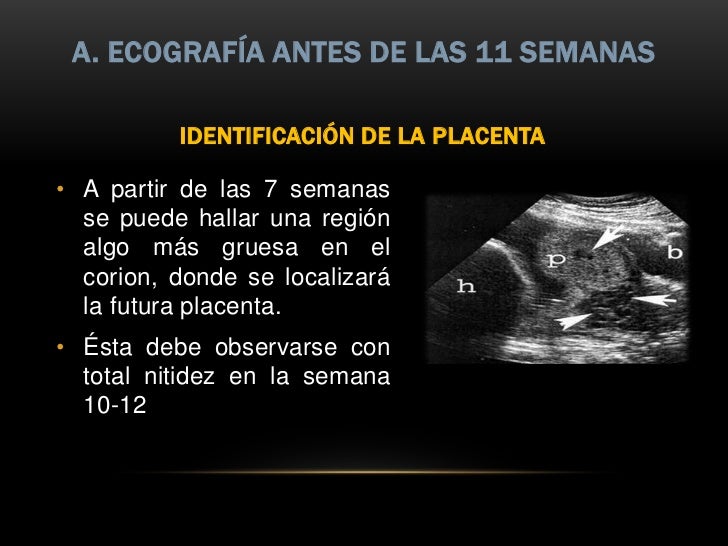 Como adelgazar rápidamente de la obesidad