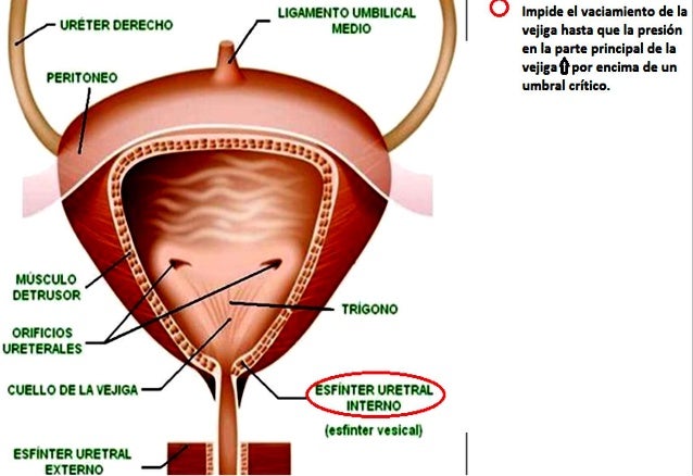 Rf lifting las personas que este tal