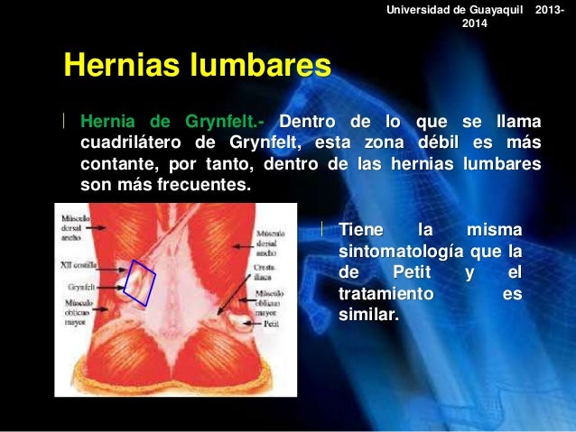 Tratamientos de las Hernias lumbares, Hernias glúteas, Hernias del…