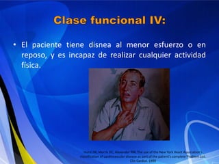 • El paciente tiene disnea al menor esfuerzo o en
reposo, y es incapaz de realizar cualquier actividad
física.

Hurst JW, Morris DC, Alexander RW. The use of the New York Heart Association's
classification of cardiovascular disease as part of the patient's complete Problem List.
Clin Cardiol. 1999

 