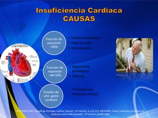 Fracción de
expulsión
<40%

• Infarto miocárdico
• Hipertensión
• Valvulopatía

Fracción de
expulsión
>40-50%

• Hipertrofia
patológica
• Fibrosis

Estados de
alto gasto
cardiaco

•Tirotoxicosis
•Anemia crónica

GUYTON & Hall, Tratado de fisiología médica, Elsevier, 11º edición, p 112,113. ANTHONY, S Fauci, Haarison principios de
medicina interna Mc GrawHill, 17ª edición p1444-1446

 