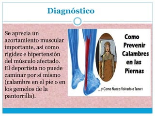 Diagnóstico
Se aprecia un
acortamiento muscular
importante, así como
rigidez e hipertensión
del músculo afectado.
El deportista no puede
caminar por sí mismo
(calambre en el pie o en
los gemelos de la
pantorrilla).
 