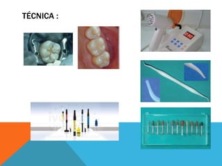 TÉCNICA :
 
