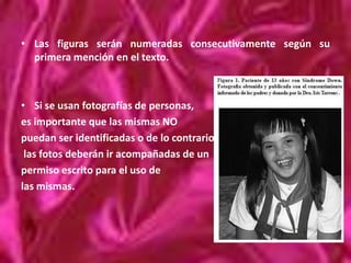 La altura de cada rectángulo es proporcional a la frecuencia del intervalo respectivo.