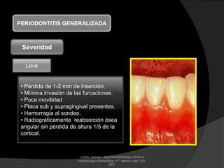 PERIODONTITIS GENERALIZADA
Severidad
Leve
• Pérdida de 1-2 mm de inserción.
• Mínima invasión de las furcaciones.
• Poca movilidad
• Placa sub y supragingival presentes.
• Hemorragia al sondeo.
• Radiográficamente reabsorción ósea
angular sin pérdida de altura 1/5 de la
cortical.
Lindhe karring – lang Periodontologia clinica e
inplantologia odontologica 4 ª edicion pag “210-
255”
 