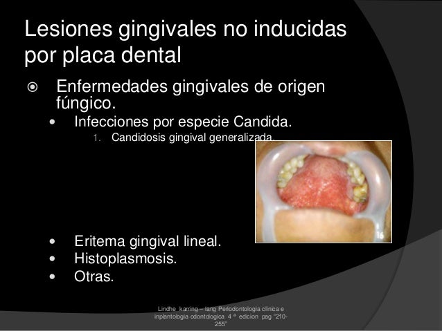 Expo de periodoncia
