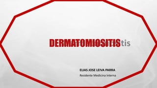DERMATOMIOSITIS
ELIAS JOSE LEIVA PARRA
Residente Medicina Interna
 