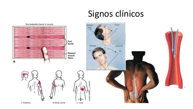 Puntos Puntos