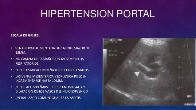 Hipertensiunea Portala Cauze Simptome Complicatii Tratament