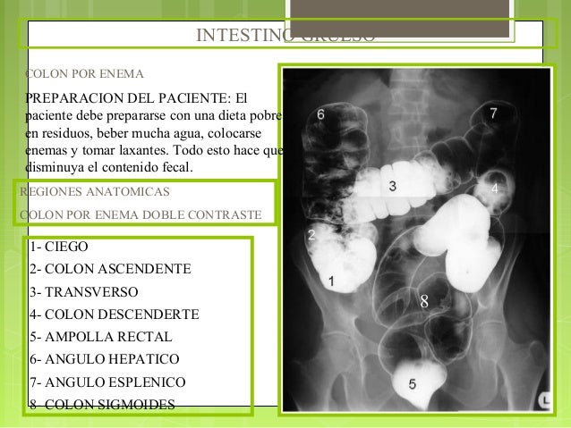 preparacion para colon por enema doble contraste preparacion para colon por enema doble contraste