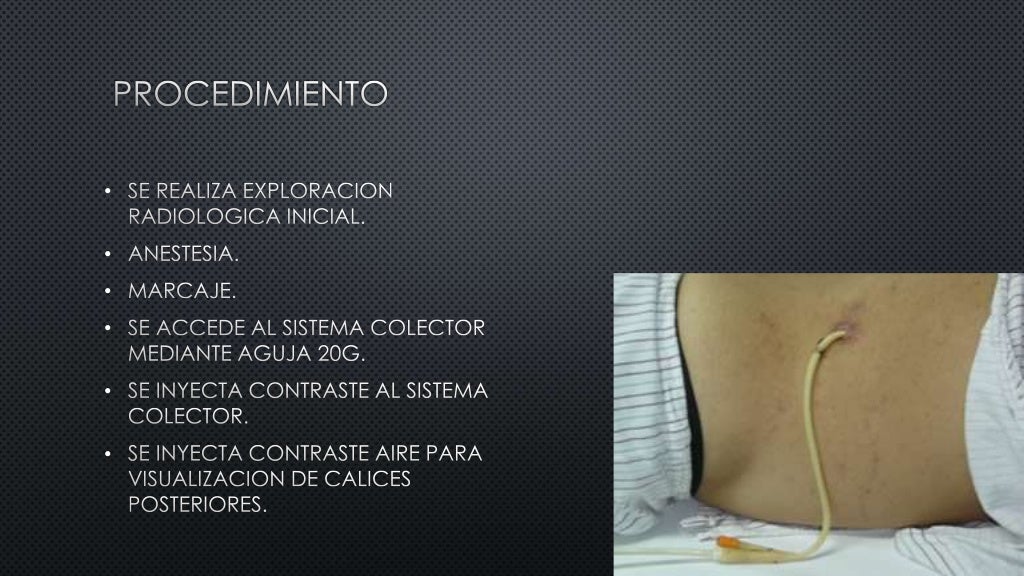 View of Image result for building company galerakis construction