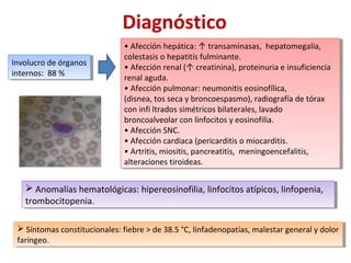 Involucro de órganos
internos: 88 %
Involucro de órganos
internos: 88 %
• Afección hepática: ↑ transaminasas, hepatomegalia,
colestasis o hepatitis fulminante.
• Afección renal (↑ creatinina), proteinuria e insuficiencia
renal aguda.
• Afección pulmonar: neumonitis eosinofílica,
(disnea, tos seca y broncoespasmo), radiografía de tórax
con infi ltrados simétricos bilaterales, lavado
broncoalveolar con linfocitos y eosinofilia.
• Afección SNC.
• Afección cardiaca (pericarditis o miocarditis.
• Artritis, miositis, pancreatitis, meningoencefalitis,
alteraciones tiroideas.
• Afección hepática: ↑ transaminasas, hepatomegalia,
colestasis o hepatitis fulminante.
• Afección renal (↑ creatinina), proteinuria e insuficiencia
renal aguda.
• Afección pulmonar: neumonitis eosinofílica,
(disnea, tos seca y broncoespasmo), radiografía de tórax
con infi ltrados simétricos bilaterales, lavado
broncoalveolar con linfocitos y eosinofilia.
• Afección SNC.
• Afección cardiaca (pericarditis o miocarditis.
• Artritis, miositis, pancreatitis, meningoencefalitis,
alteraciones tiroideas.
Diagnóstico
 Anomalías hematológicas: hipereosinofilia, linfocitos atípicos, linfopenia,
trombocitopenia.
 Anomalías hematológicas: hipereosinofilia, linfocitos atípicos, linfopenia,
trombocitopenia.
 Síntomas constitucionales: fiebre > de 38.5 °C, linfadenopatías, malestar general y dolor
faríngeo.
 Síntomas constitucionales: fiebre > de 38.5 °C, linfadenopatías, malestar general y dolor
faríngeo.
 