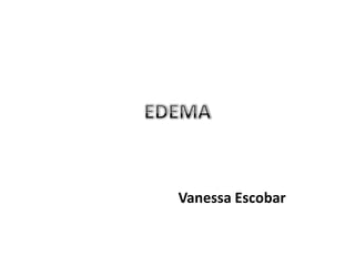 Vanessa Escobar
 