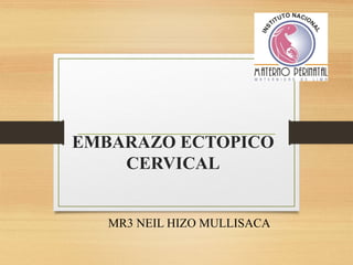 EMBARAZO ECTOPICO
CERVICAL
MR3 NEIL HIZO MULLISACA
 