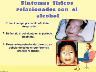 Síntomas físicos
relacionados con el
alcohol
 Inicio etapa prenatal déficit de
desarrollo
 Déficit de crecimiento en el periodo
postnatal.
 Desarrollo postnatal del cerebro es
deficiente como circunferencia
craneal reducida,
 