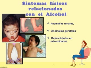 Síntomas físicos
relacionados
con el Alcohol
 Anomalías renales,
 Anomalías genitales
 Deformidades en
extremidades
 