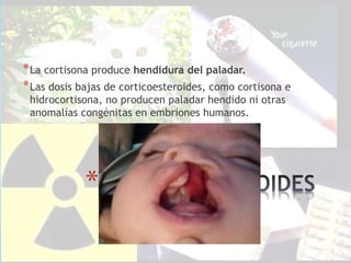 *
*La cortisona produce hendidura del paladar.
*Las dosis bajas de corticoesteroides, como cortisona e
hidrocortisona, no producen paladar hendido ni otras
anomalías congénitas en embriones humanos.
 