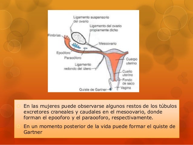 53+ Quiste De Gartner, Un artículo que describe el caso de una mujer