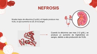 NEFROSIS
Niveles bajos de albumina (2 g/dL), el hígado produce mas
VLDL, lo que aumenta la LDL en la sangre.
Cuando la albúmina cae mas (1-2 g/dL), se
produce un aumento de triglicéridos en
sangre, debido a alta producción de VLDL
 