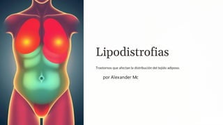Lipodistrofias
Trastornos que afectan la distribución del tejido adiposo.
por Alexander Mc
 
