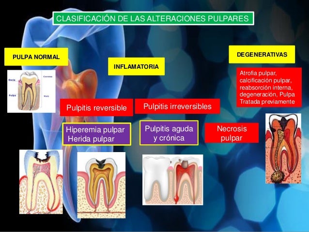 ESTADIOS PULPARES