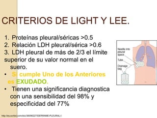 CRITERIOS DE LIGHT Y LEE.
  1. Proteínas pleural/séricas >0.5
  2. Relación LDH pleural/sérica >0.6
  3. LDH pleural de más de 2/3 el límite
  superior de su valor normal en el
    suero.
  • Si cumple Uno de los Anteriores
   es EXUDADO.
  • Tienen una significancia diagnostica
    con una sensibilidad del 98% y
    especificidad del 77%
http://es.scribd.com/doc/36096227/DERRAME-PLEURAL-I
 