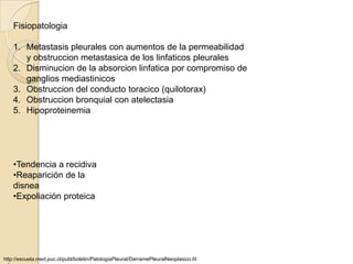 Fisiopatologia

    1. Metastasis pleurales con aumentos de la permeabilidad
       y obstruccion metastasica de los linfaticos pleurales
    2. Disminucion de la absorcion linfatica por compromiso de
       ganglios mediastinicos
    3. Obstruccion del conducto toracico (quilotorax)
    4. Obstruccion bronquial con atelectasia
    5. Hipoproteinemia




    •Tendencia a recidiva
    •Reaparición de la
    disnea
    •Expoliación proteica




http://escuela.med.puc.cl/publ/boletin/PatologiaPleural/DerramePleuralNeoplasico.ht
 