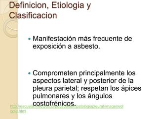 Definicion, Etiologia y
Clasificacion

               Manifestación más frecuente de
                exposición a asbesto.


             Comprometen principalmente los
              aspectos lateral y posterior de la
              pleura parietal; respetan los ápices
              pulmonares y los ángulos
              costofrénicos.
http://escuela.med.puc.cl/publ/boletin/patologiapleural/imageneol
ogia.html
 
