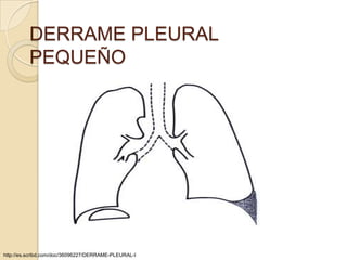 DERRAME PLEURAL
          PEQUEÑO




http://es.scribd.com/doc/36096227/DERRAME-PLEURAL-I
 