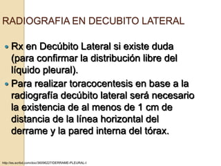 RADIOGRAFIA EN DECUBITO LATERAL

  Rx en Decúbito Lateral si existe duda
   (para confirmar la distribución libre del
   líquido pleural).
  Para realizar toracocentesis en base a la
   radiografía decúbito lateral será necesario
   la existencia de al menos de 1 cm de
   distancia de la línea horizontal del
   derrame y la pared interna del tórax.


http://es.scribd.com/doc/36096227/DERRAME-PLEURAL-I
 