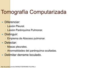 Tomografía Computarizada
    Diferenciar:
     ◦ Lesión Pleural.
     ◦ Lesión Parénquima Pulmonar.
    Distinguir:
     ◦ Empiema de Absceso pulmonar.
    Detectar:
     ◦ Masas pleurales.
     ◦ Anormalidades del parénquima ocultadas.
    Delimitar derrame loculado.


http://es.scribd.com/doc/36096227/DERRAME-PLEURAL-I
 