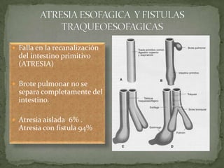  Falla en la recanalización
del intestino primitivo
(ATRESIA)
 Brote pulmonar no se
separa completamente del
intestino.
 Atresia aislada 6% .
Atresia con fístula 94%
 