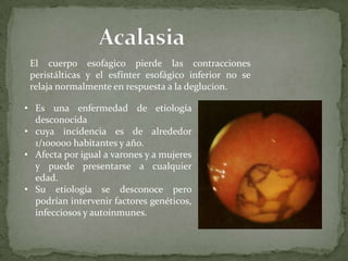 El cuerpo esofagico pierde las contracciones
peristálticas y el esfínter esofágico inferior no se
relaja normalmente en respuesta a la deglucion.
• Es una enfermedad de etiología
desconocida
• cuya incidencia es de alrededor
1/100000 habitantes y año.
• Afecta por igual a varones y a mujeres
y puede presentarse a cualquier
edad.
• Su etiología se desconoce pero
podrían intervenir factores genéticos,
infecciosos y autoinmunes.
 