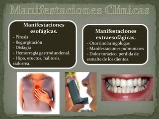 Manifestaciones
esofágicas.
- Pirosis
- Regurgitación
- Disfagia
- Hemorragia gastroduodenal.
- Hipo, eructos, halitosis,
sialorrea.
Manifestaciones
extraesofágicas.
- Otorrinolaringólogas
- Manifestaciones pulmonares
- Dolor torácico, perdida de
esmalte de los dientes.
 