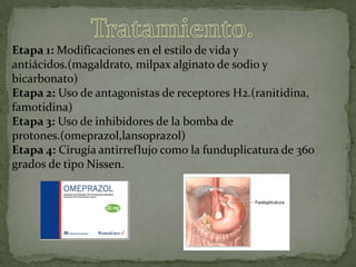 Etapa 1: Modificaciones en el estilo de vida y
antiácidos.(magaldrato, milpax alginato de sodio y
bicarbonato)
Etapa 2: Uso de antagonistas de receptores H2.(ranitidina,
famotidina)
Etapa 3: Uso de inhibidores de la bomba de
protones.(omeprazol,lansoprazol)
Etapa 4: Cirugía antirreflujo como la funduplicatura de 360
grados de tipo Nissen.
 