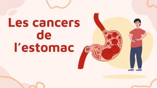 Les cancers
de
l’estomac
 