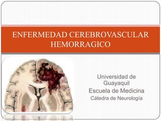 ENFERMEDAD CEREBROVASCULAR
HEMORRAGICO

Universidad de
Guayaquil
Escuela de Medicina
Cátedra de Neurología

 