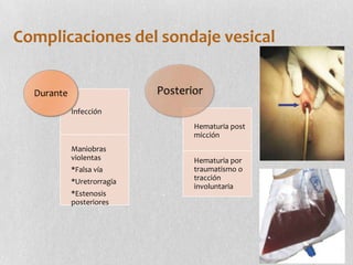 sondaje-vesical-y-talla-vesical-pptx