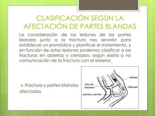 CLASIFICACIÓN SEGÚN LA 
AFECTACIÓN DE PARTES BLANDAS 
La consideración de las lesiones de las partes 
blandas junto a la fractura nos servirán para 
establecer un pronóstico y planificar el tratamiento, y 
en función de estas lesiones podemos clasificar a las 
fracturas en abiertas y cerradas; según exista ó no 
comunicación de la fractura con el exterior. 
 Fractura y partes blandas 
afectadas 
 