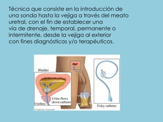 Técnica que consiste en la introducción de
una sonda hasta la vejiga a través del meato
uretral, con el fin de establecer una
vía de drenaje, temporal, permanente o
intermitente, desde la vejiga al exterior
con fines diagnósticos y/o terapéuticos.
 