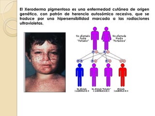 Radiaciones ultravioleta