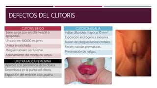 DEFECTOS DEL CLITORIS
CLITORIS BIFIDO
Suele surgir con extrofia vesical o
epispadias.
Un caso en 480000 mujeres.
Uretra ensanchada.
Pliegues labiales sin fusionar.
Aplanamiento del monte de venus.
URETRA FALICA FEMENINA
Aparece con persistencia de la cloaca.
Desemboca en la punta del clítoris.
Exposición del embrión a la cocaína.
CLITOROMEGALIA
Índice clitorideo mayor a 10 mm²
Exposición androgénica excesiva.
Fusión de pliegues labioescrotales.
Recién nacidas prematuras.
Presentación de nalgas.
 