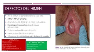 DEFECTOS DEL HIMEN
 Por lo común se perfora durante la vida fetal.
 HIMEN IMPERFORADO:
 Acumulamiento de sangre o moco en la vagina.
 Hidrocolpos/mucocolpos (puede causar
hidronefrosis).
 Protuberancia violácea en el introito.
 Laparoscopia con himenectomia.
 Diferenciar de quistes himenales de la recién nacida.
SINTOMAS
Dolor cíclico
Amenorrea
Dolor abdominal
Dificultad para orinar y
defecar.
COMPLICACION
Endometriosis por
menstruación
retrograda.
 