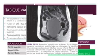 TABIQUE VAGINAL TRANSVERSO
 No se produce la fusión de los conductos de
Muller ni la canalización de la lamina vaginal.
 Puede ser OBSTRUCTIVO o NO OBSTRUCTIVO.
 1 cm como espesor promedio (hasta 5-6 cm).
 Acumulación de liquido y moco en tercio
superior.
 Piomucocolpos, piometra, piosalpinge.
 Pocas anomalías urológicas.
LOCALIZACION FRECUENCIA
Tercio superior. 46%
Zona media. 35%
Tercio inferior. 19%
DIFERENCIAR DEL HIMEN IMPERFORADO.
Dx: ecografía y resonancia
magnética.
Tx: ablación con anastomosis
terminoterminal, técnica de plastia en Z.
 