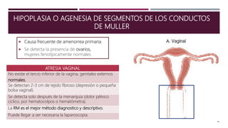 HIPOPLASIA O AGENESIA DE SEGMENTOS DE LOS CONDUCTOS
DE MULLER
 Causa frecuente de amenorrea primaria.
 Se detecta la presencia de ovarios,
mujeres fenotípicamente normales.
ATRESIA VAGINAL
No existe el tercio inferior de la vagina, genitales externos
normales.
Se detectan 2-3 cm de tejido fibroso (depresión o pequeña
bolsa vaginal).
Se detecta solo después de la menarquia (dolor pélvico
cíclico, por hematocolpos o hematómetra).
La RM es el mejor método diagnostico y descriptivo.
Puede llegar a ser necesaria la laparoscopia.
 
