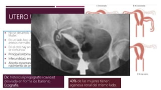 UTERO UNICORNE
 No se desarrolla ni elonga uno de los conductos de
Muller.
 En un lado hay útero funcional, cuello uterino normal y
anexos normales.
 En el otro hay un cuerno uterino rudimentario, que no
se comunica.
 Principal síntoma: dolor unilateral cíclico.
 Infecundidad, endometriosis y dismenorrea.
 Aborto espontaneo (36%), parto prematuro (16%) y
nacimiento de producto vivo (54%).
Dx: histerosalpingografia (cavidad
desviada en forma de banana).
Ecografía.
40% de las mujeres tienen
agenesia renal del mismo lado.
 